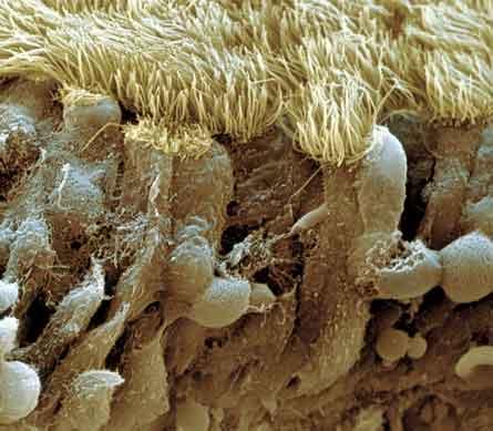 Apresenta epitélio com células colunares produtoras de muco (umedece e aprisiona partículas) e células ciliadas; Mucosa também