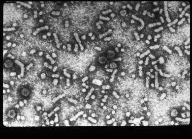 Vírus da hepatite B-HBV Classificação Família Hepadnaviridae Gênero
