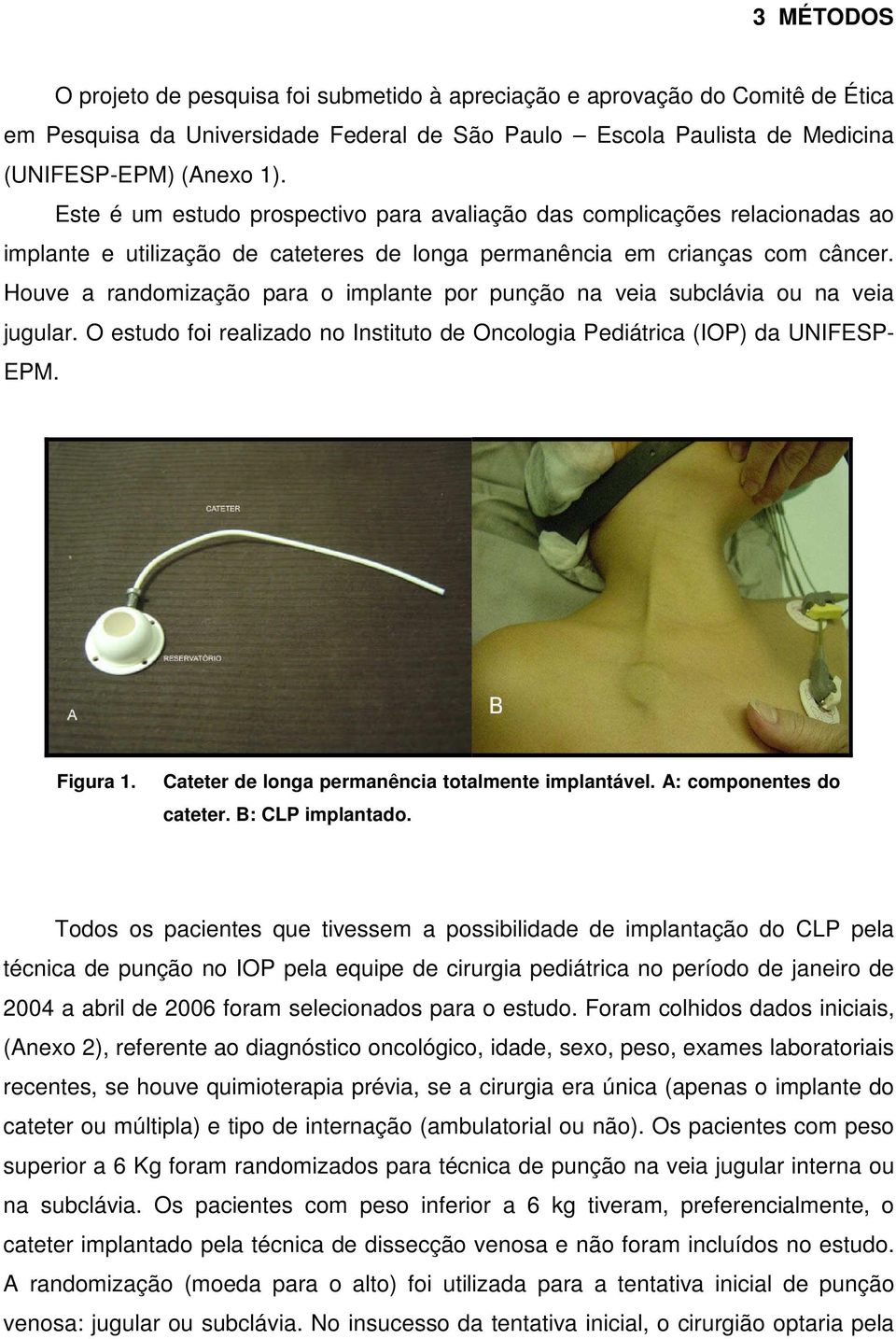 Houve a randomização para o implante por punção na veia subclávia ou na veia jugular. O estudo foi realizado no Instituto de Oncologia Pediátrica (IOP) da UNIFESP- EPM. Figura 1.