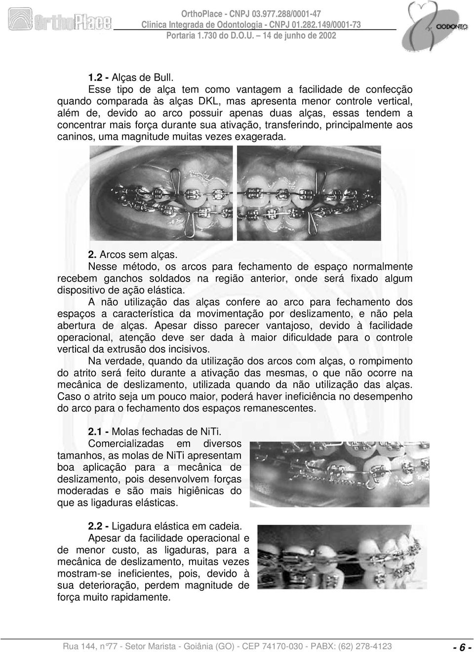 concentrar mais força durante sua ativação, transferindo, principalmente aos caninos, uma magnitude muitas vezes exagerada. 2. Arcos sem alças.