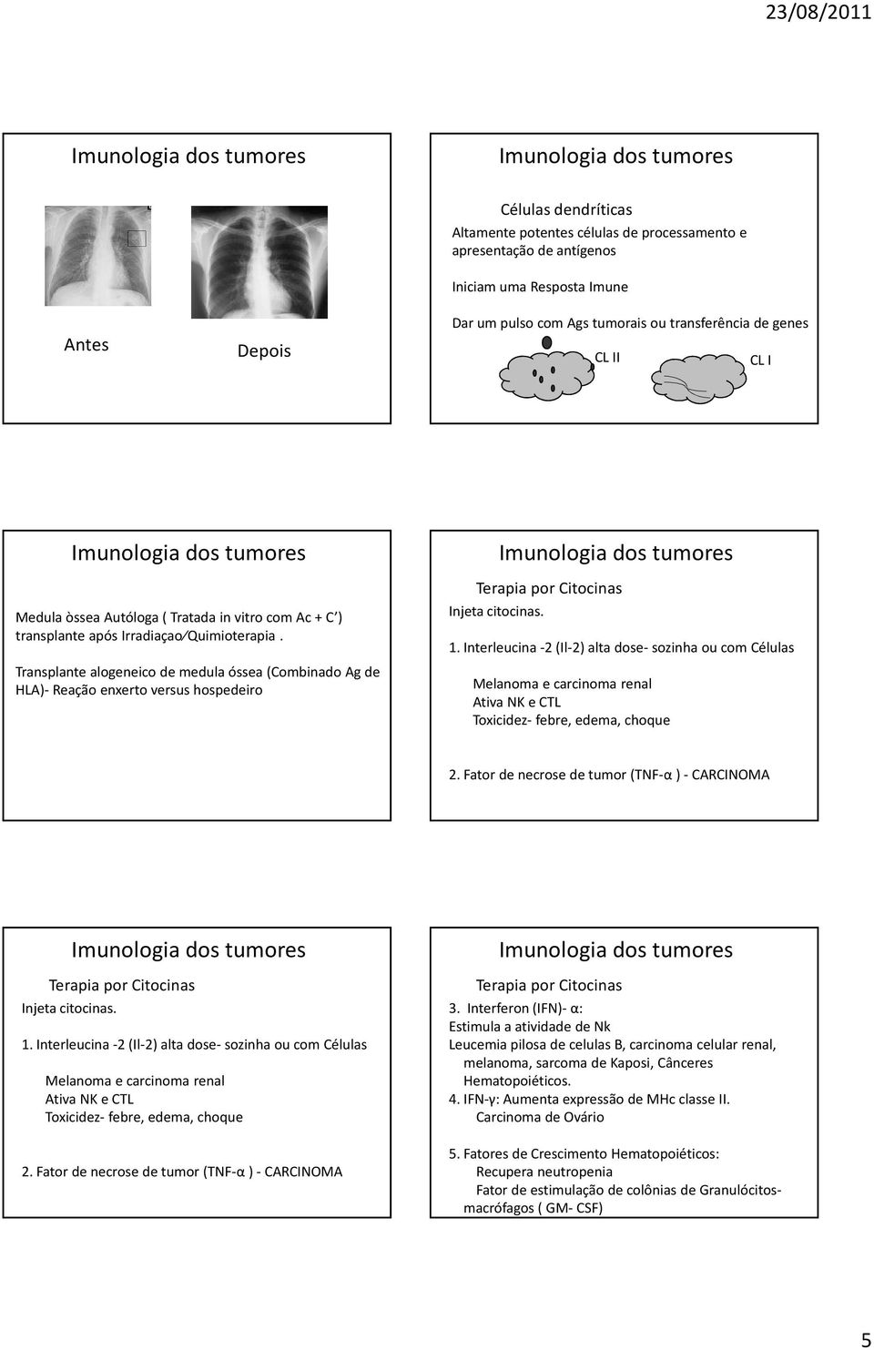 Transplante alogeneico de medula óssea (Combinado Agde HLA)- Reação enxerto versus hospedeiro Terapia por Citocinas Injeta citocinas. 1.