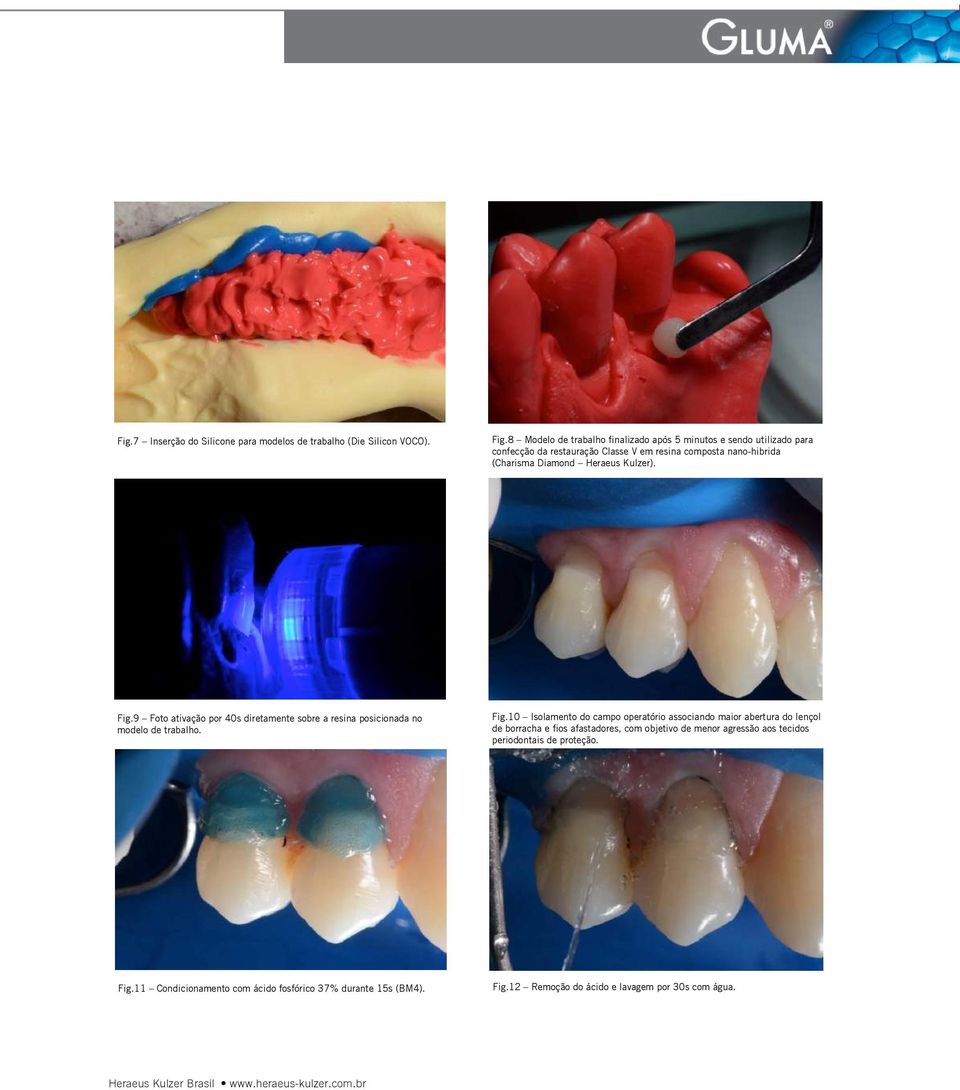 Heraeus Kulzer). Fig.