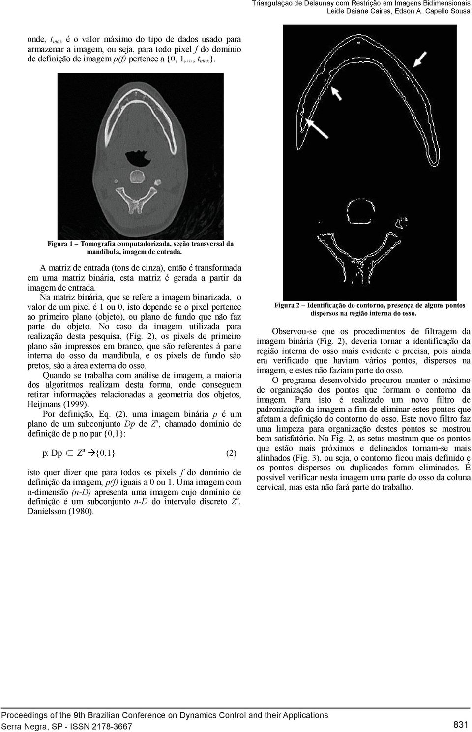 Figura 1 Tomografia computadorizada, seção transversal da mandíbula, imagem de entrada.