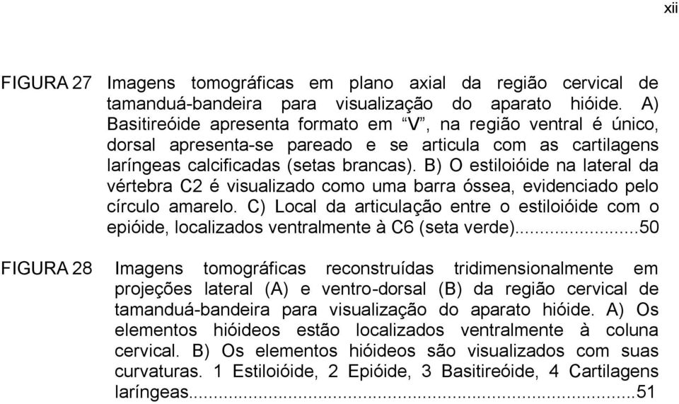 B) O estiloióide na lateral da vértebra C2 é visualizado como uma barra óssea, evidenciado pelo círculo amarelo.