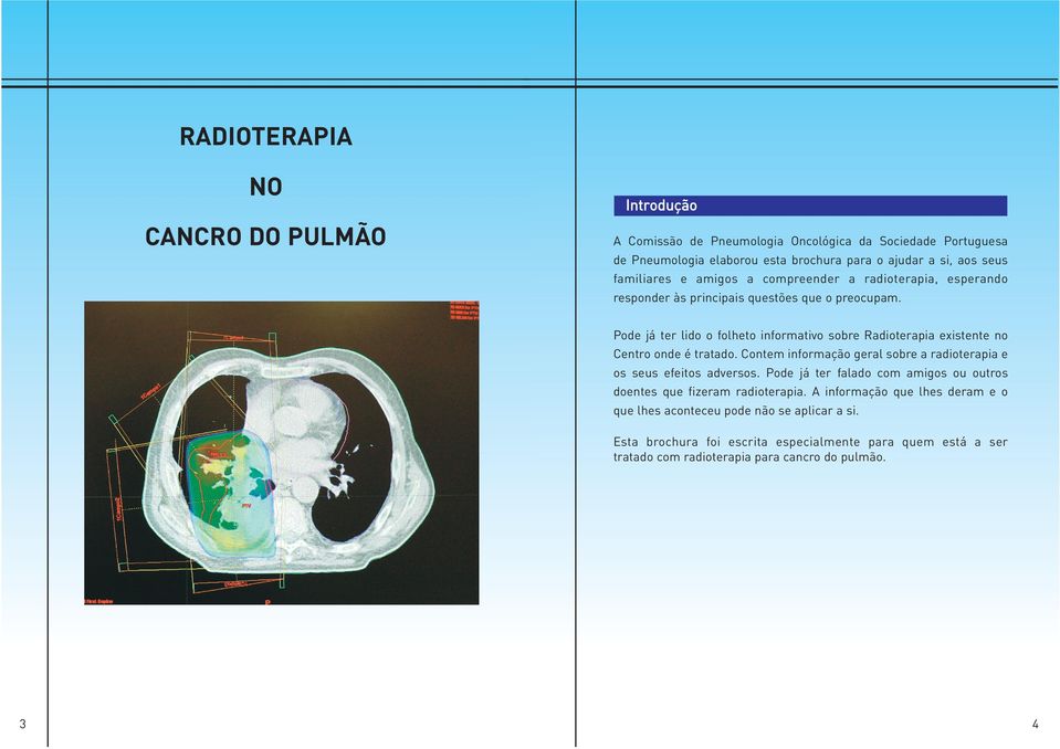 Pode já ter lido o folheto informativo sobre Radioterapia existente no Centro onde é tratado. Contem informação geral sobre a radioterapia e os seus efeitos adversos.