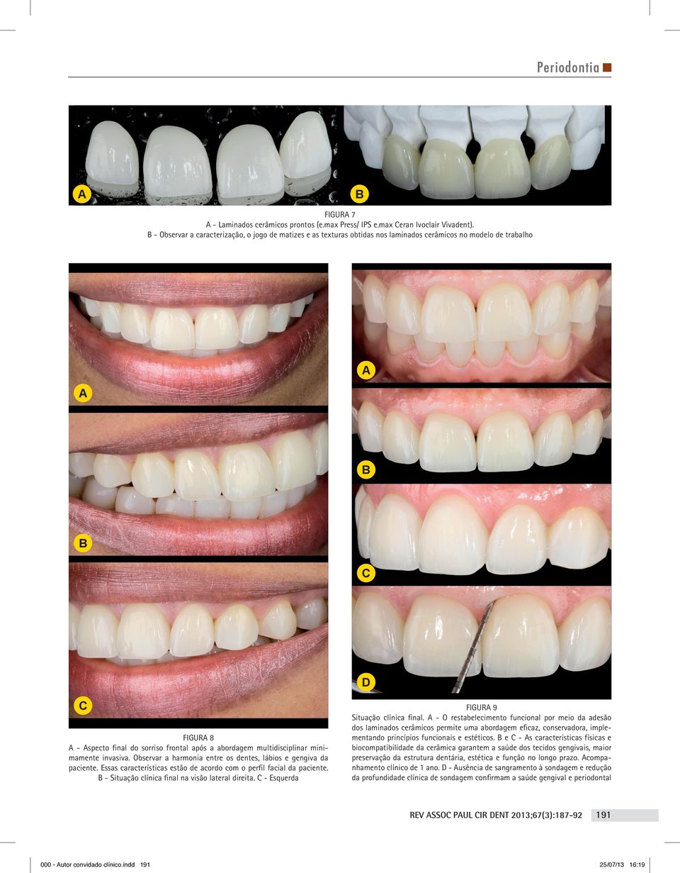 multidisciplinar minimamente invasiva. Observar a harmonia entre os dentes, lábios e gengiva da paciente. Essas características estão de acordo com o perfil facial da paciente.