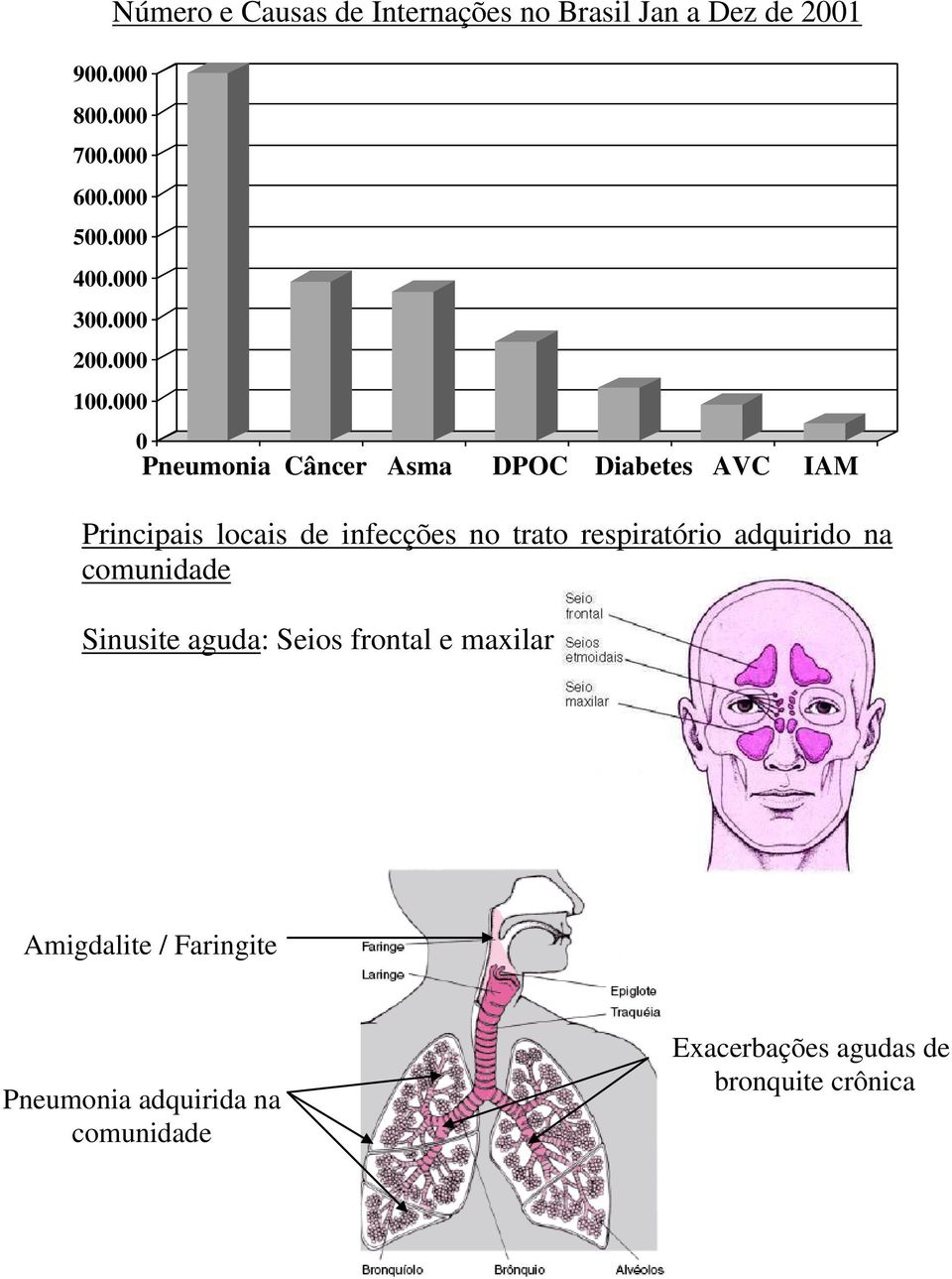 000 0 Pneumonia Câncer Asma DPOC Diabetes AVC IAM Principais locais de infecções no trato