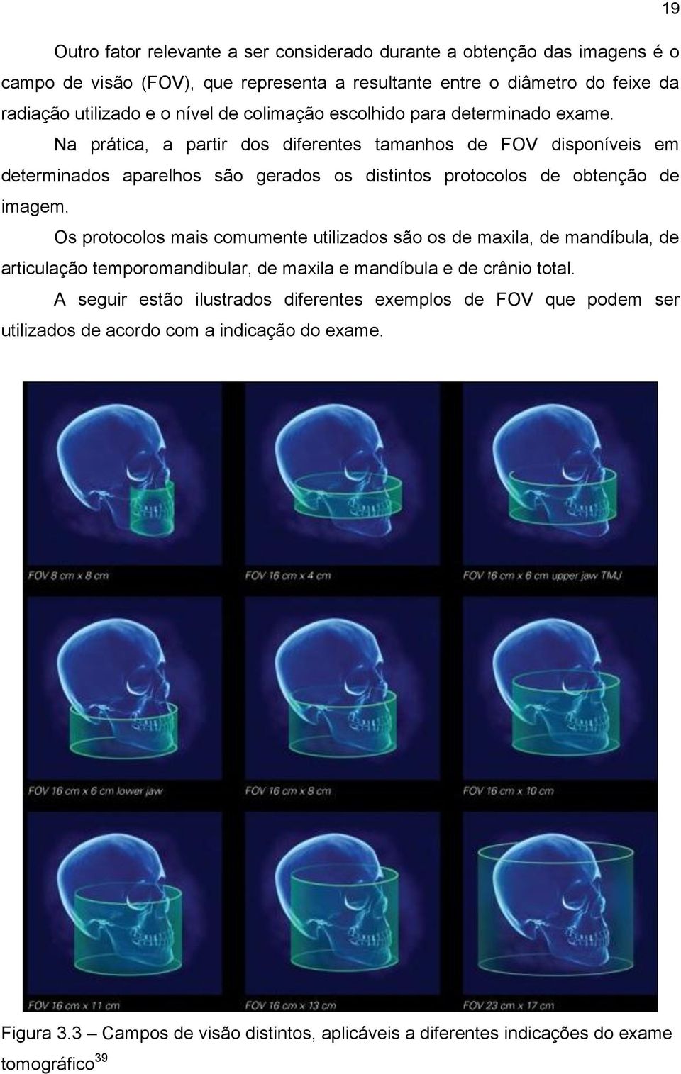 Na prática, a partir dos diferentes tamanhos de FOV disponíveis em determinados aparelhos são gerados os distintos protocolos de obtenção de imagem.