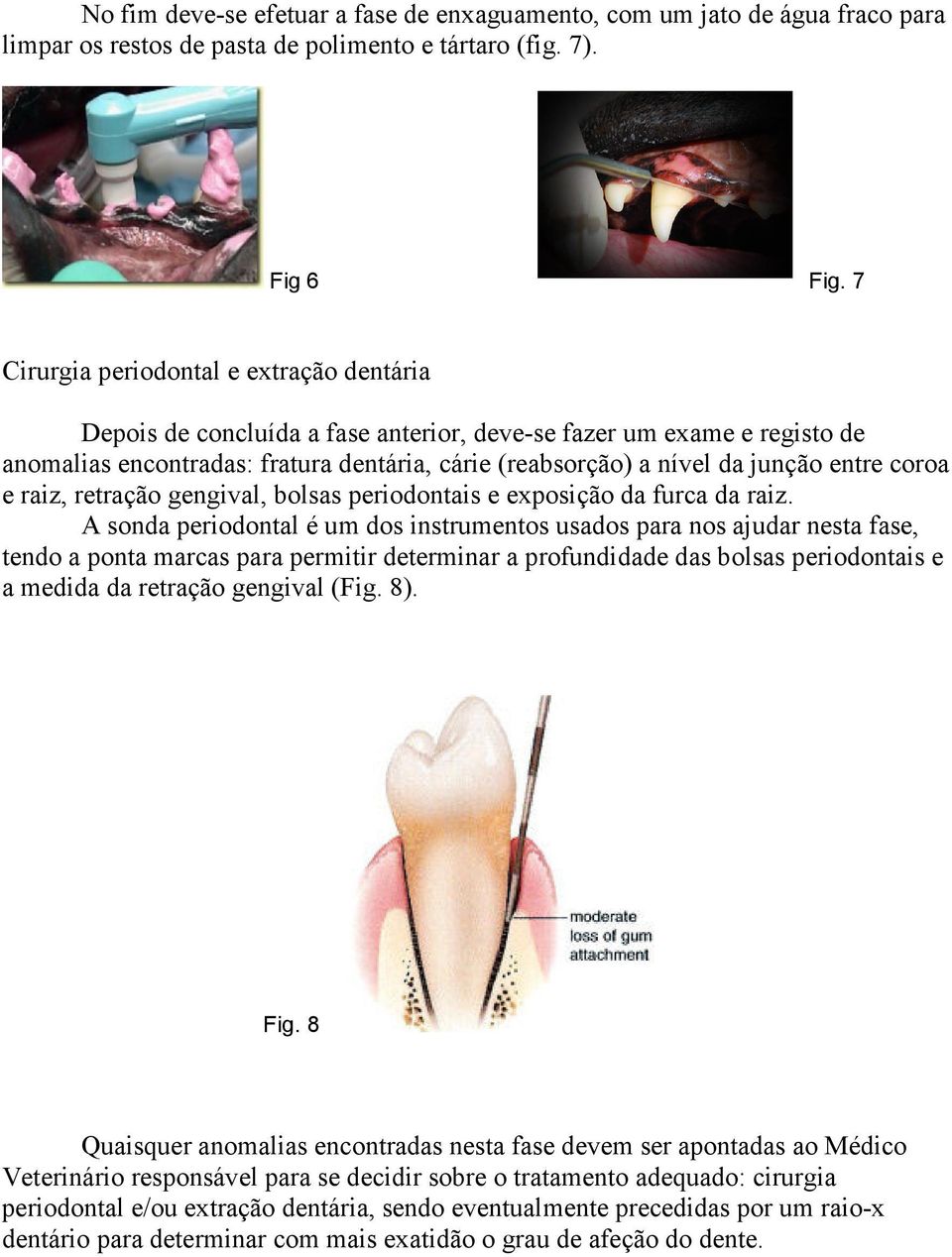 coroa e raiz, retração gengival, bolsas periodontais e exposição da furca da raiz.