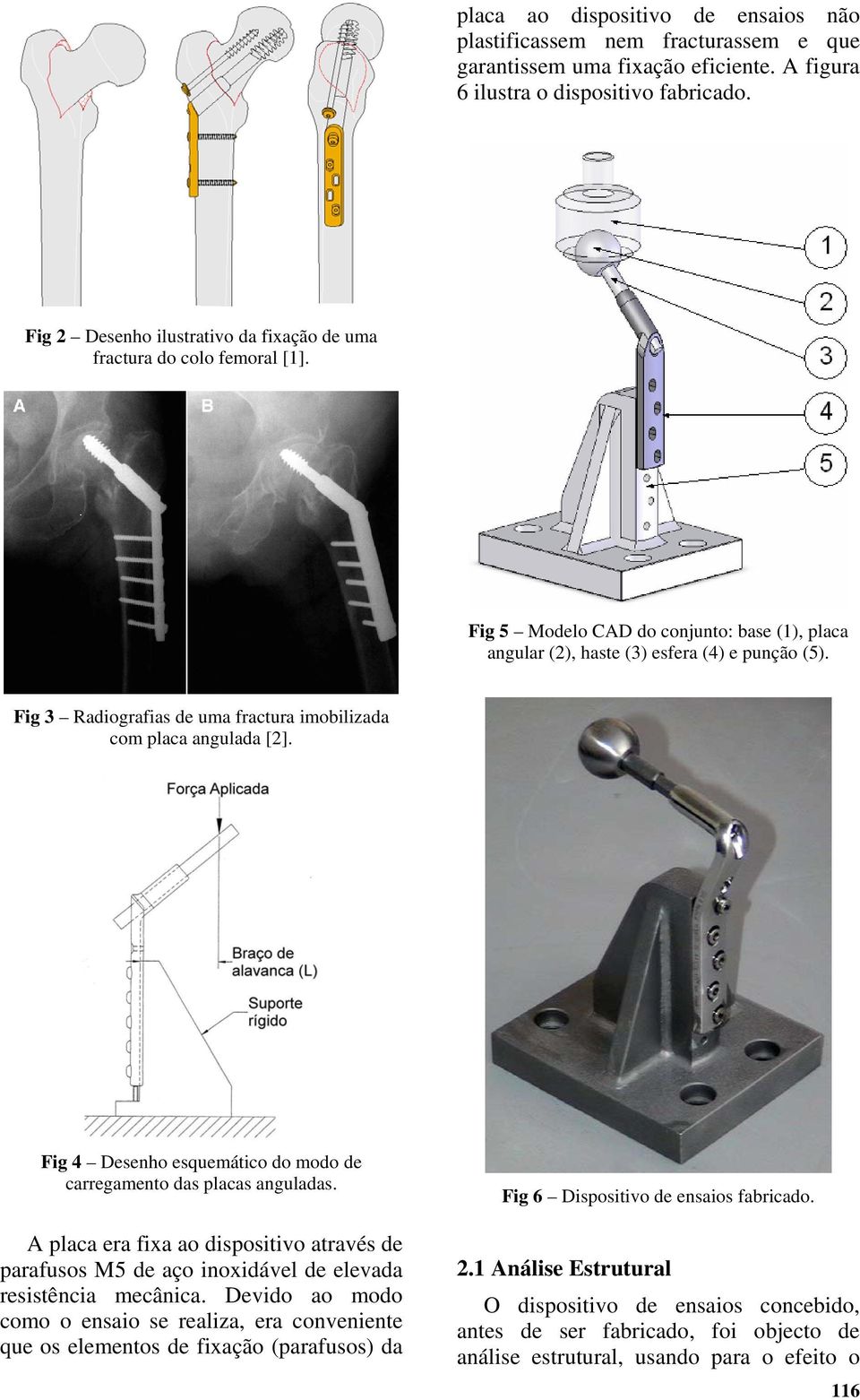 Fig 3 Radiografias de uma fractura imobilizada com placa angulada [2]. Fig 4 Desenho esquemático do modo de carregamento das placas anguladas.