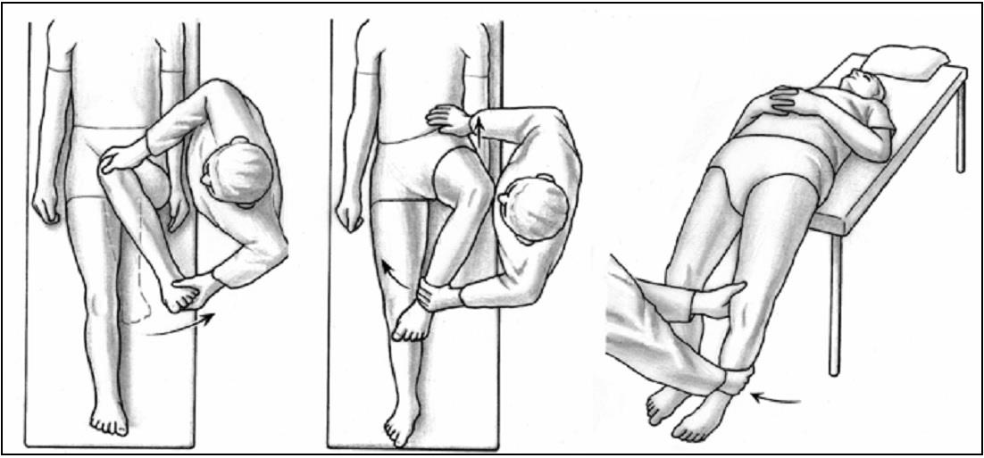 Figura 7 [9] - Sinal "C" - Doentes quando descrevem o desconforto na anca irão referir a mesma colocando a face palmar da mão no grande trocânter e os dedos a apontar para a virilha.