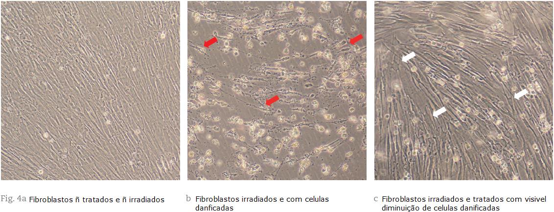 Fig.3 Viabilidade dos fibroblastos após radiação UVA.
