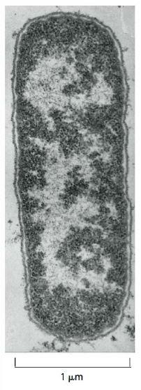 Estrutura de uma bactéria Em geral a organização é simples: Possuem uma parede celular, logo