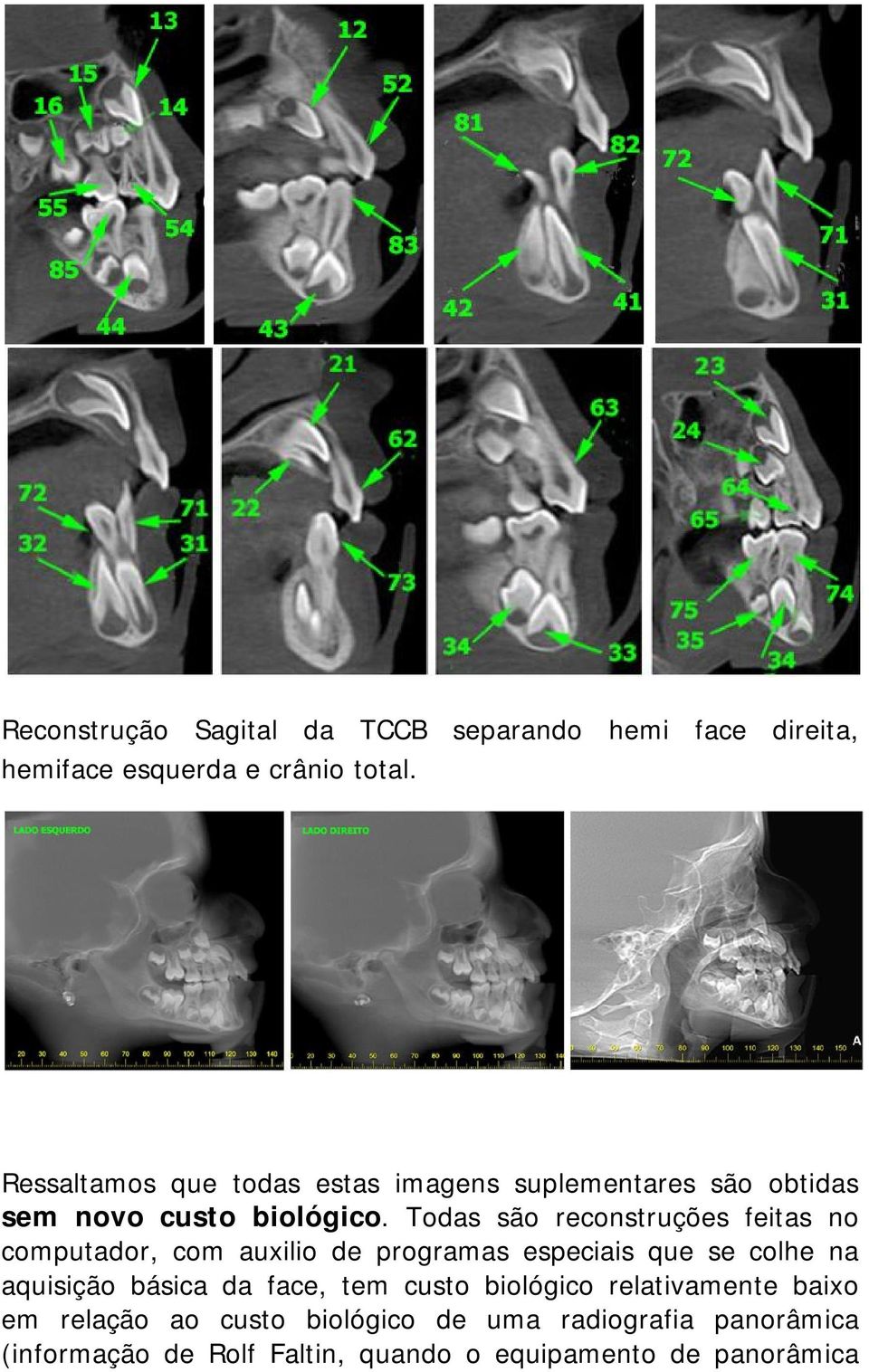 Todas são reconstruções feitas no computador, com auxilio de programas especiais que se colhe na aquisição básica da
