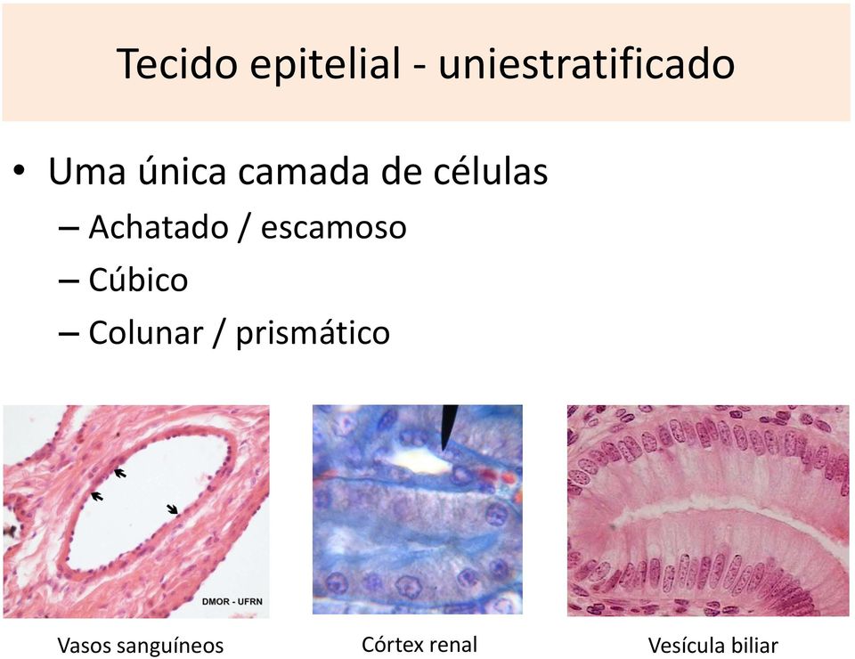 escamoso Cúbico Colunar / prismático