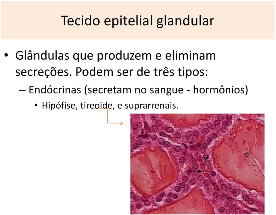 Podem ser de três tipos: Endócrinas