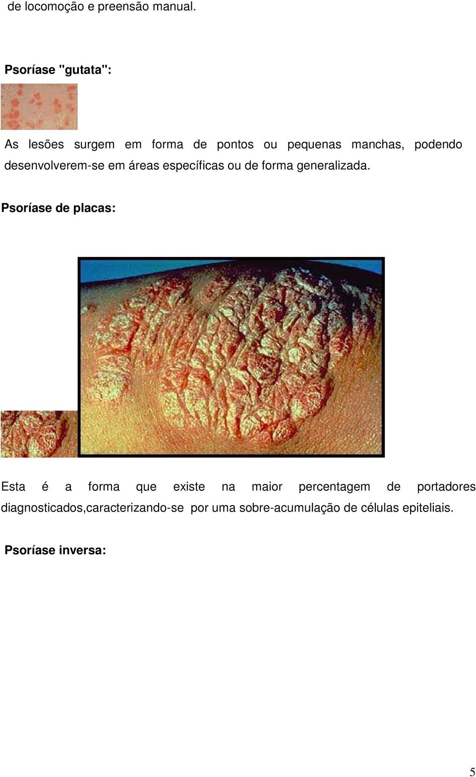 desenvolverem-se em áreas específicas ou de forma generalizada.