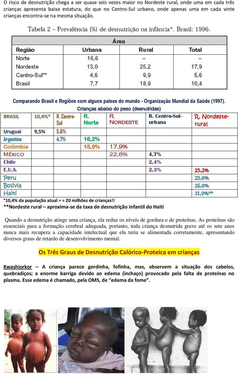 Centro- Sul Crianças abaixo do peso (desnutridas) R. R. R. Centro-Sul- Norte Nordeste urbana R.