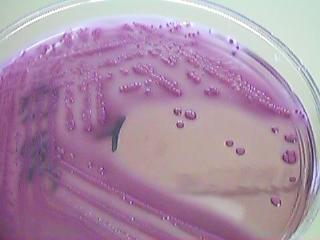 Klebsiella Enterobacter Serratia -