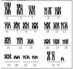 Aluno (a): Biologia 1- O número de cromossomos da espécie humana pode, às vezes, apresentar alterações.