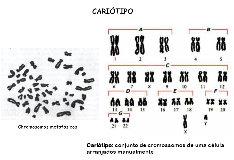 CARIÓTIPO Consiste na ordenação dos cromossomos homólogos em pares, segundo o tipo e o tamanho Verificar se há excesso