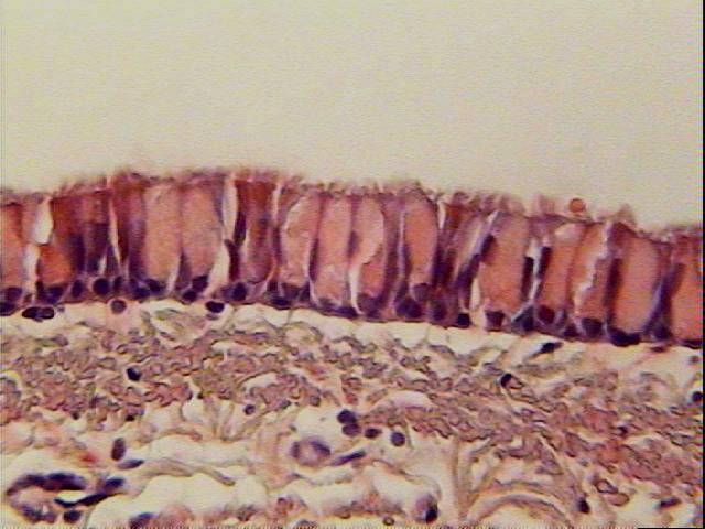 TECIDO EPITELIAL Apoiado numa camada de tecido conjuntivo. Ligado a este pela membrana basal, que é sintetizada pelas células epiteliais.