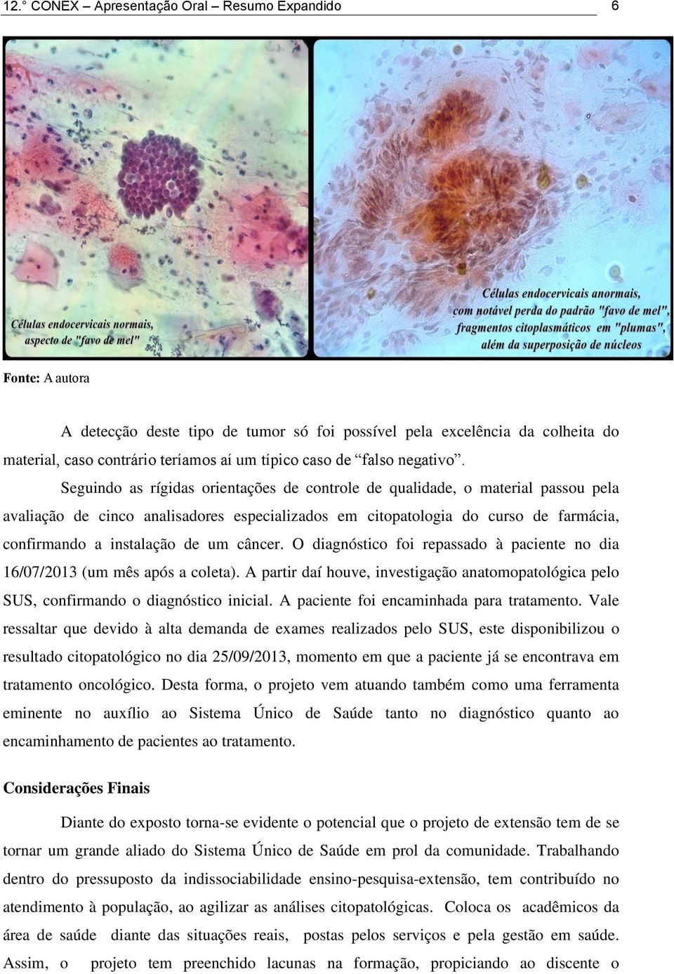 Seguindo as rígidas orientações de controle de qualidade, o material passou pela avaliação de cinco analisadores especializados em citopatologia do curso de farmácia, confirmando a instalação de um