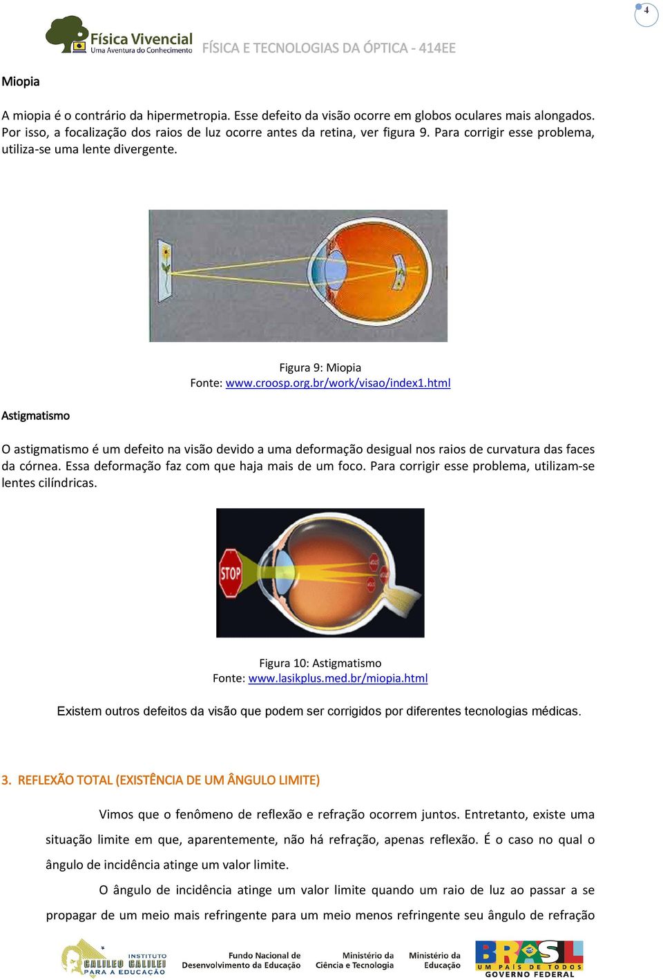 html O astigmatismo é um deeito na visão devido a uma deormação desigual nos raios de curvatura das aces da córnea. Essa deormação az com que haja mais de um oco.
