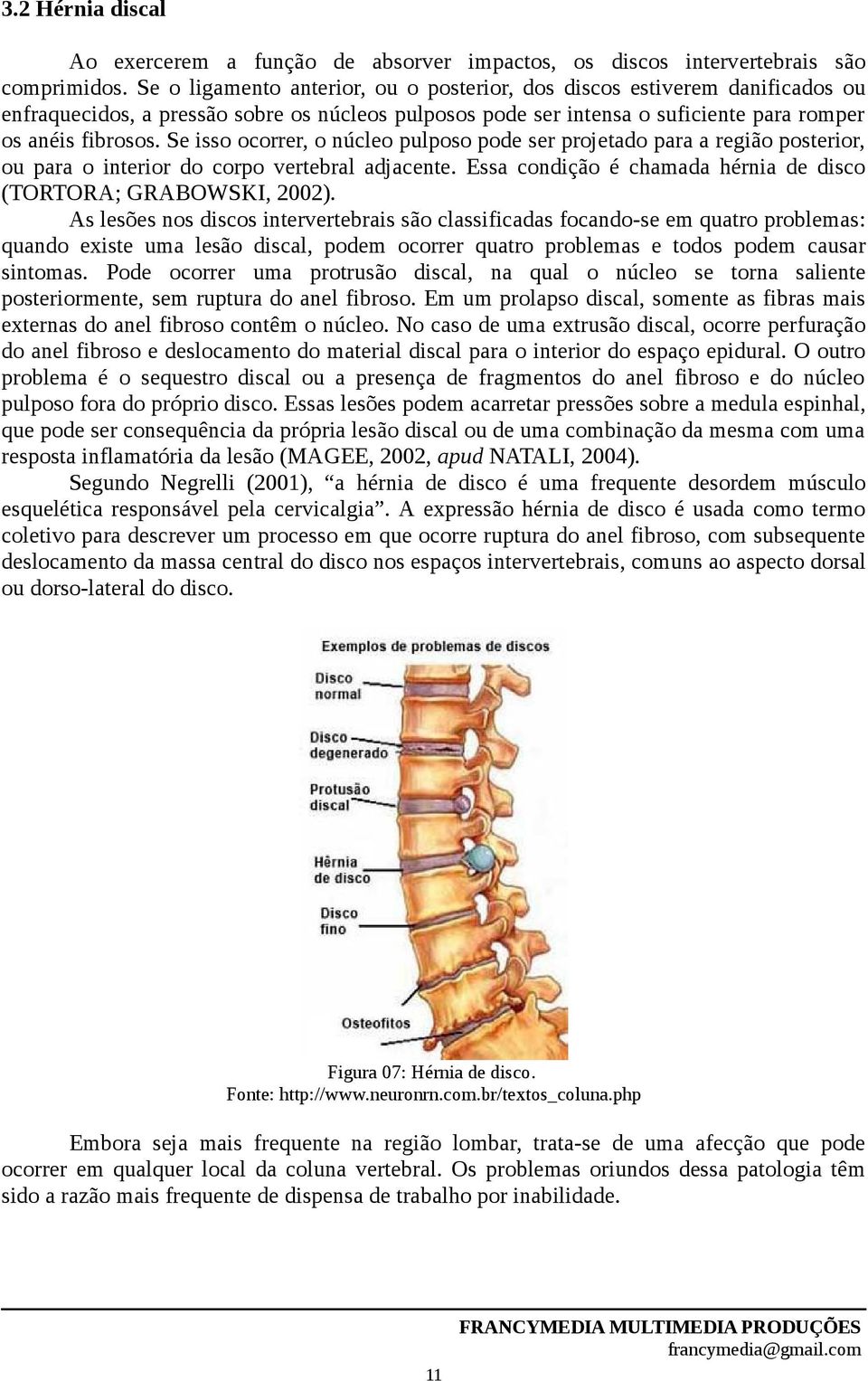 Se isso ocorrer, o núcleo pulposo pode ser projetado para a região posterior, ou para o interior do corpo vertebral adjacente. Essa condição é chamada hérnia de disco (TORTORA; GRABOWSKI, 2002).