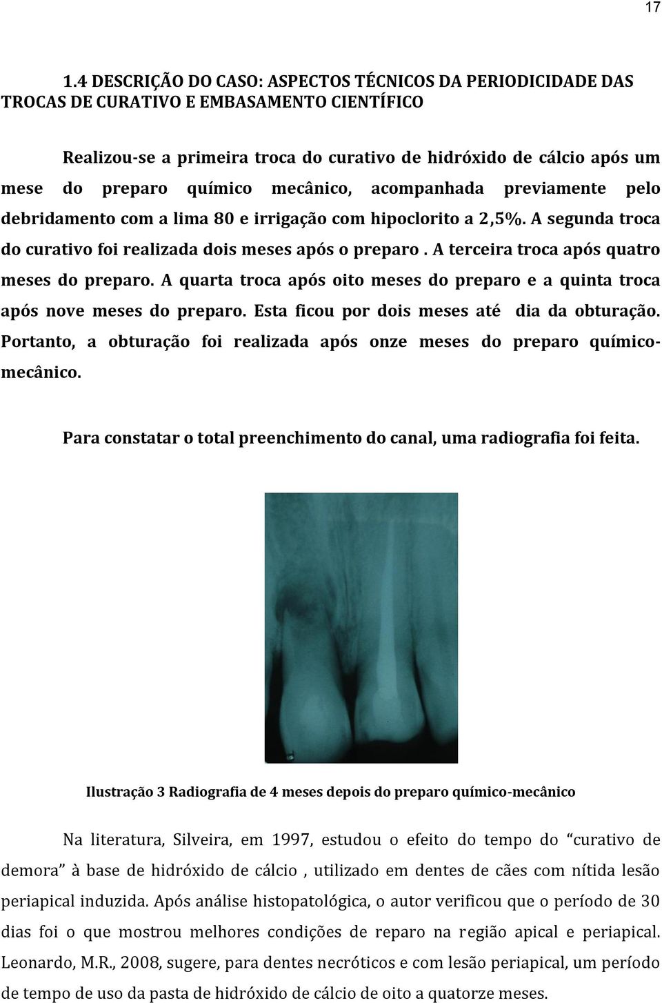 A terceira troca após quatro meses do preparo. A quarta troca após oito meses do preparo e a quinta troca após nove meses do preparo. Esta ficou por dois meses até dia da obturação.