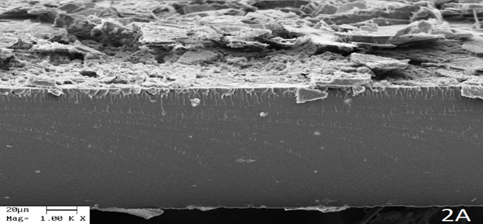 Conforme pode ser observado na Figura 1, os espectros de infravermelho da membrana de fibroína de seda pura e de fibroína de seda tratada em etanol 70% diferem.