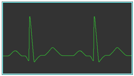 Onda P Despolarização Atrial Complexo QRS Despolarização