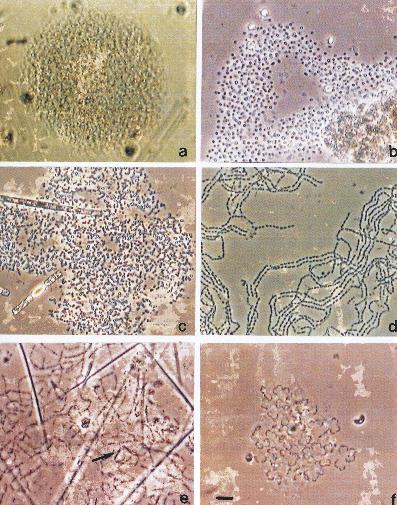 Variações morfológicas: Unicelulares picoplanctônicas < 5µm Colônias nanoplanctônicas 5-20µm