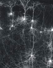 Morfologia do Neurônio CORPO