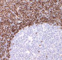 Tecido linfóide central Células B precursoras Medula óssea Célula B progenitora LINFOMA DE CÉLULAS DO MANTO Célula pré-b Célula B imatura Zona do manto Apoptose Célula B de memória Célula B naive