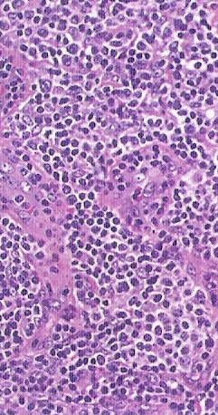 Tecido linfóide central Células T precursoras Pró-timócito Progenitor de