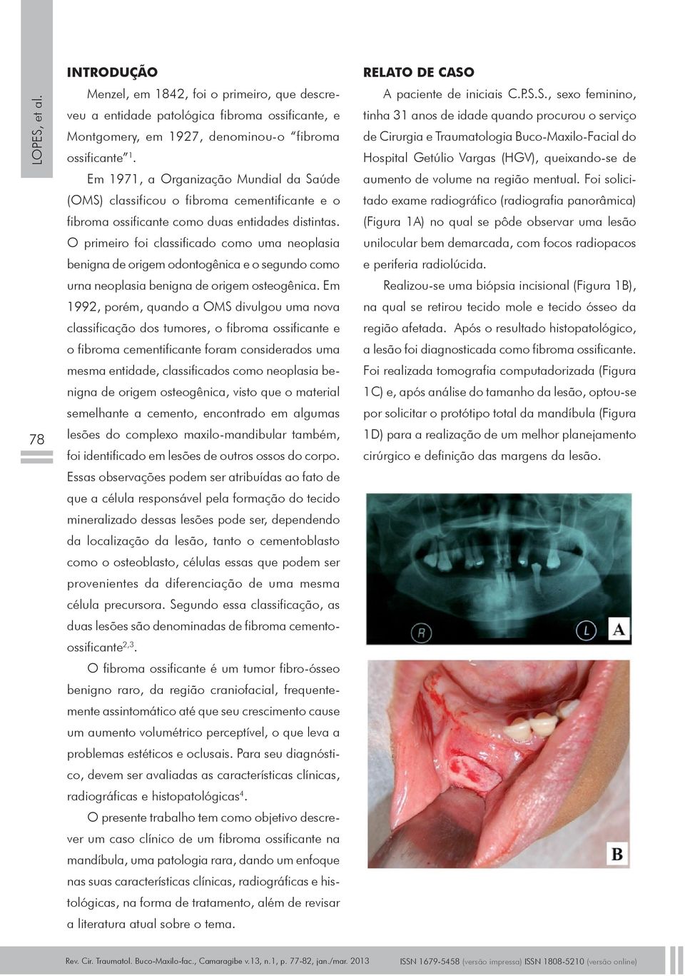 O primeiro foi classificado como uma neoplasia benigna de origem odontogênica e o segundo como urna neoplasia benigna de origem osteogênica.