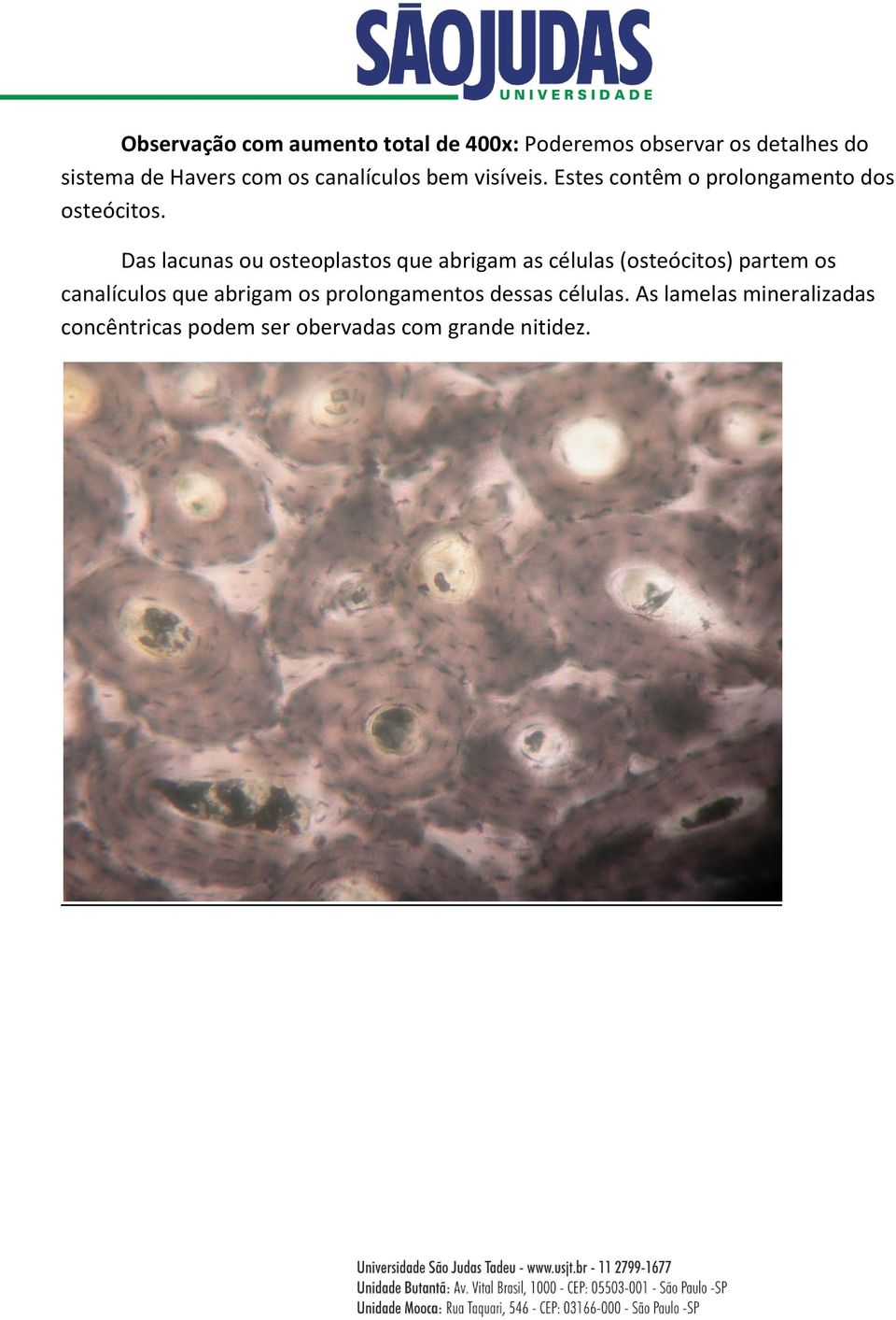 Das lacunas ou osteoplastos que abrigam as células (osteócitos) partem os canalículos que