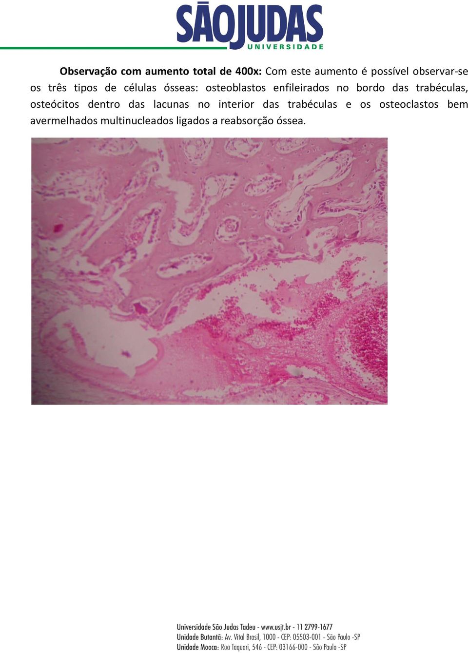 bordo das trabéculas, osteócitos dentro das lacunas no interior das