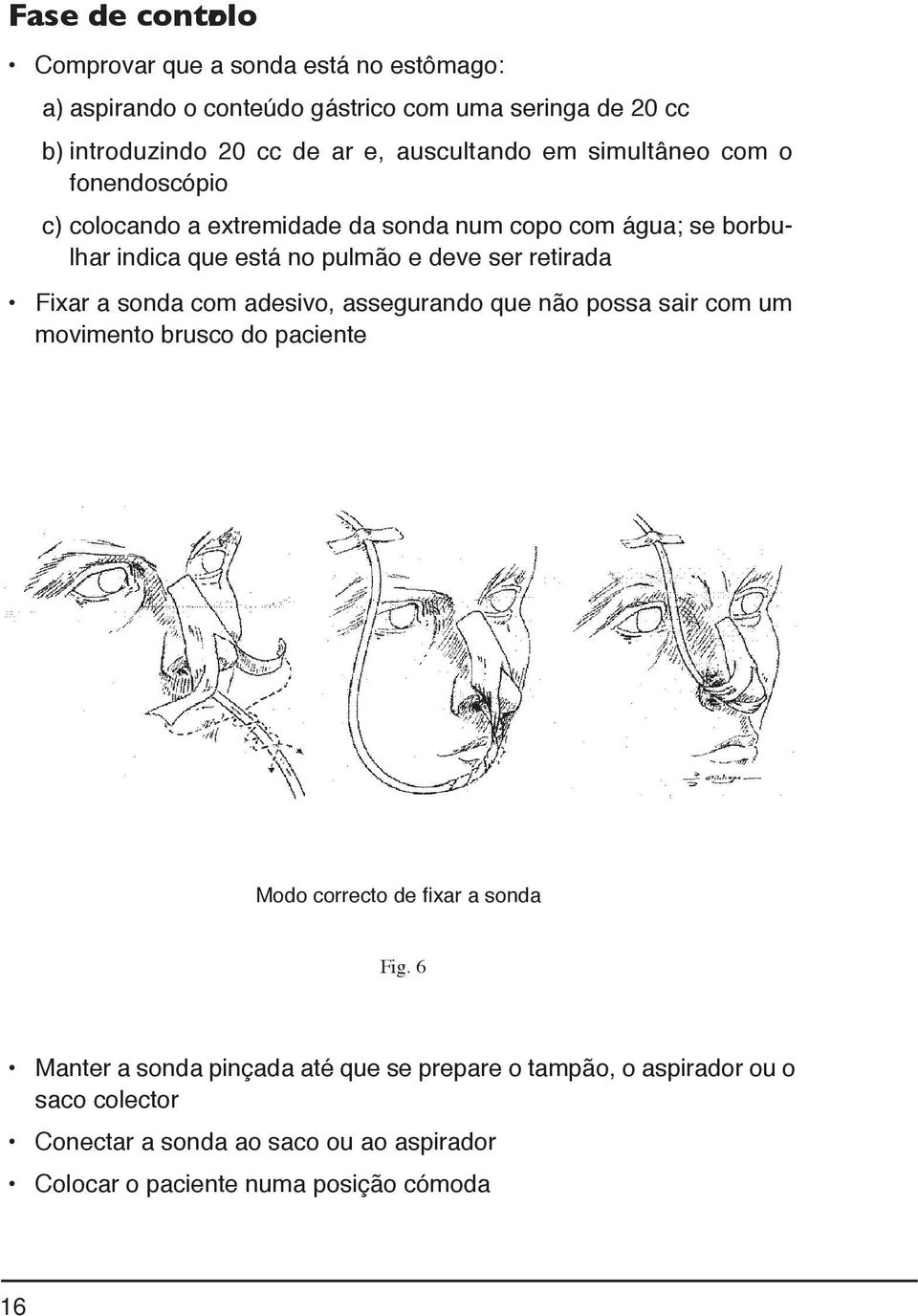 retirada Fixar a sonda com adesivo, assegurando que não possa sair com um movimento brusco do paciente Modo correcto de fixar a sonda Fig.