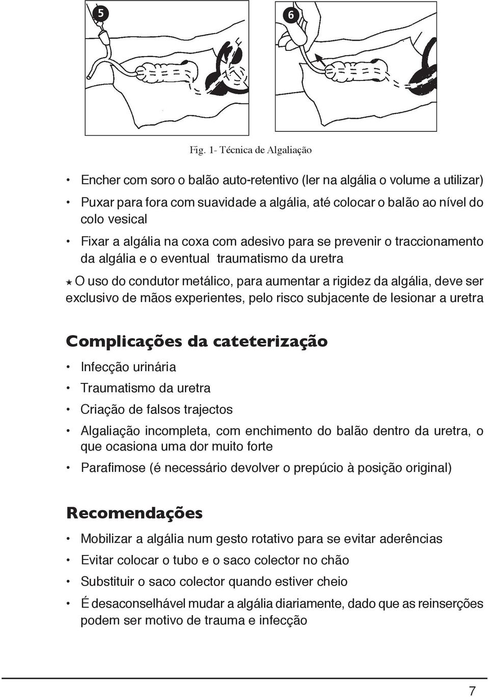 algália na coxa com adesivo para se prevenir o traccionamento da algália e o eventual traumatismo da uretra O uso do condutor metálico, para aumentar a rigidez da algália, deve ser exclusivo de mãos