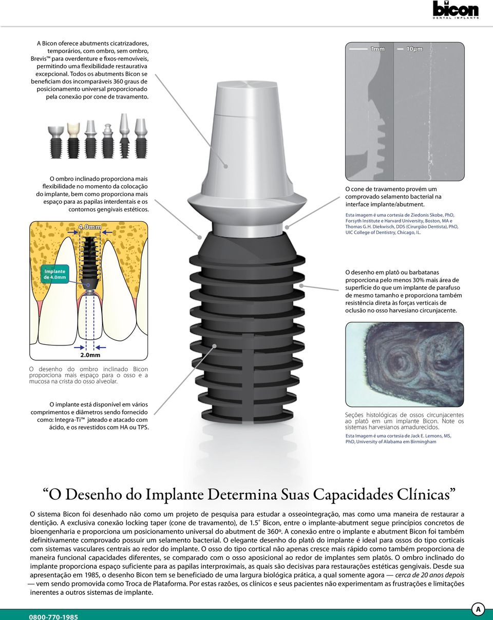 1mm 10µm O ombro inclinado proporciona mais flexibilidade no momento da colocação do implante, bem como proporciona mais espaço para as papilas interdentais e os contornos gengivais estéticos. 4.