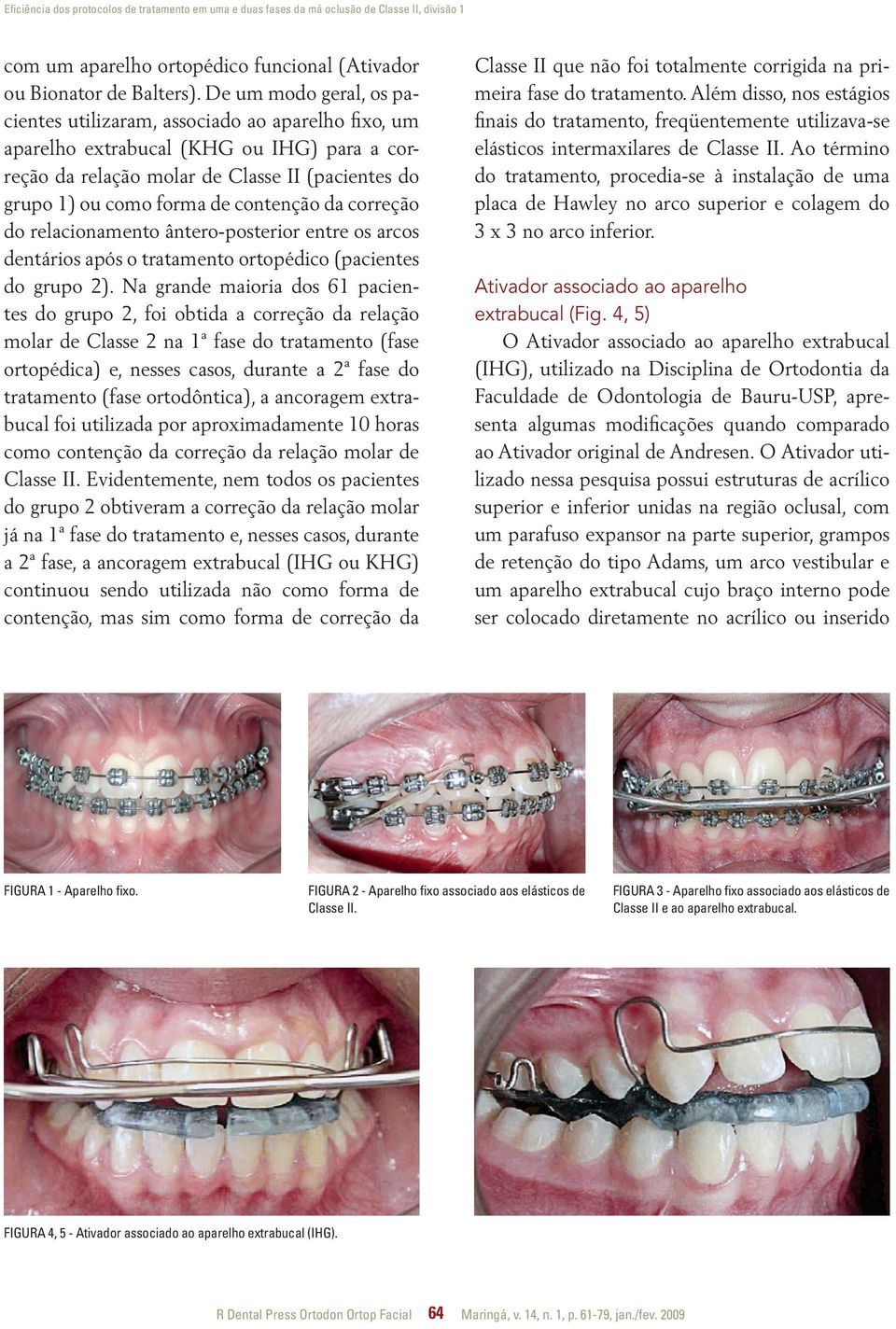 contenção da correção do relacionamento ântero-posterior entre os arcos dentários após o tratamento ortopédico (pacientes do grupo 2).