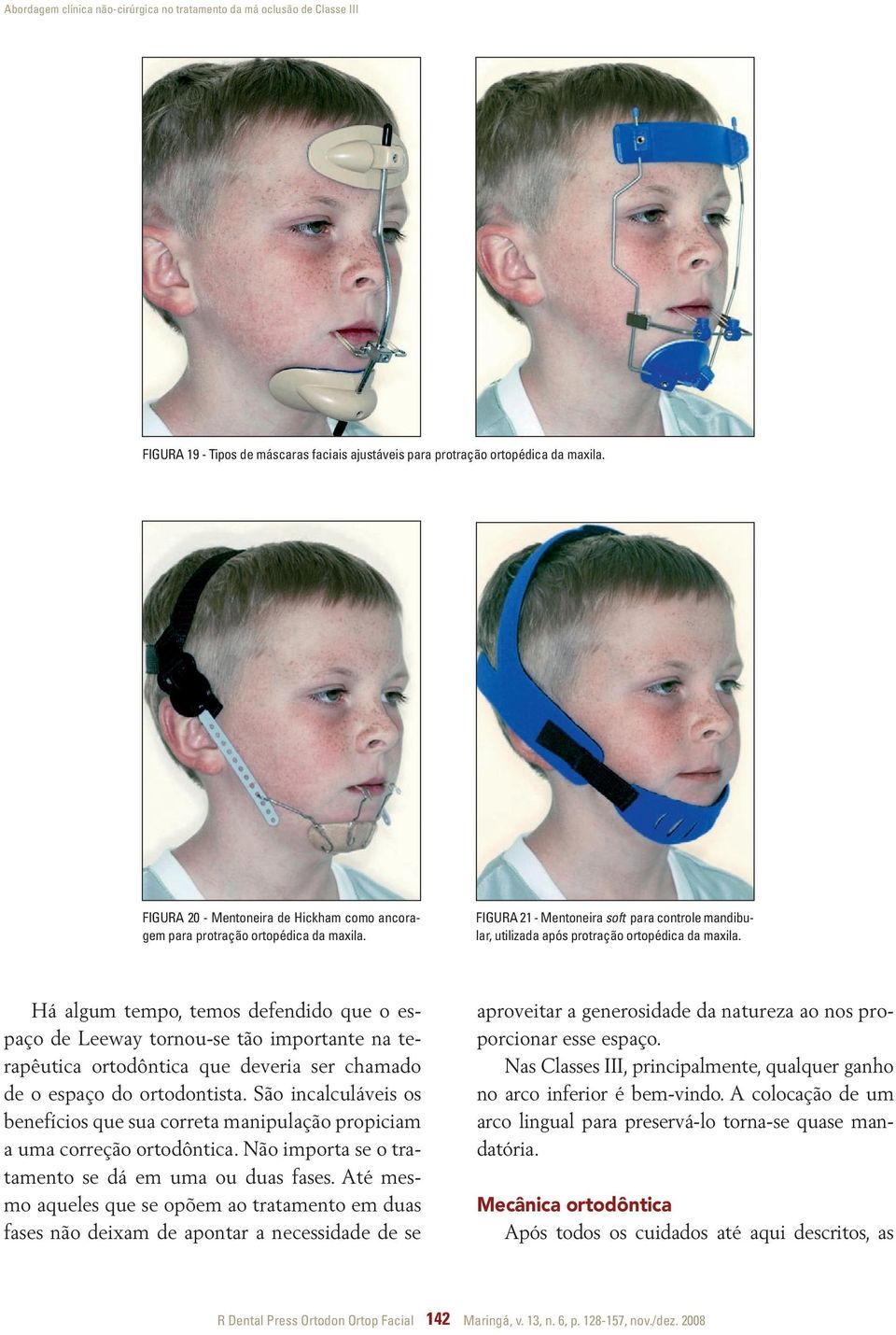 Há algum tempo, temos defendido que o espaço de Leeway tornou-se tão importante na terapêutica ortodôntica que deveria ser chamado de o espaço do ortodontista.