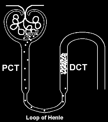 Exame microscópico - Cilindros Eritrocitários