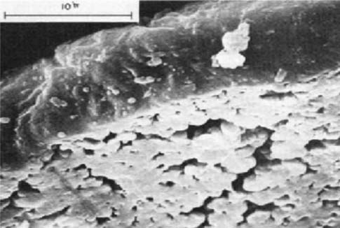 Figura 1. Estrutura morfológica das partículas da resina de suspensão de PVC Figura 3. Micrografia da resina de suspensão de PVC obtida através de microscopia eletrônica de varredura (MEV). Figura 2.