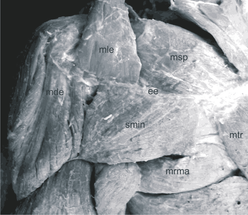 Morfologia dos músculos do ombro do Sapajus apella 133 FIGURA 2: Região escapular do Sapajus apella em vista dorsal.