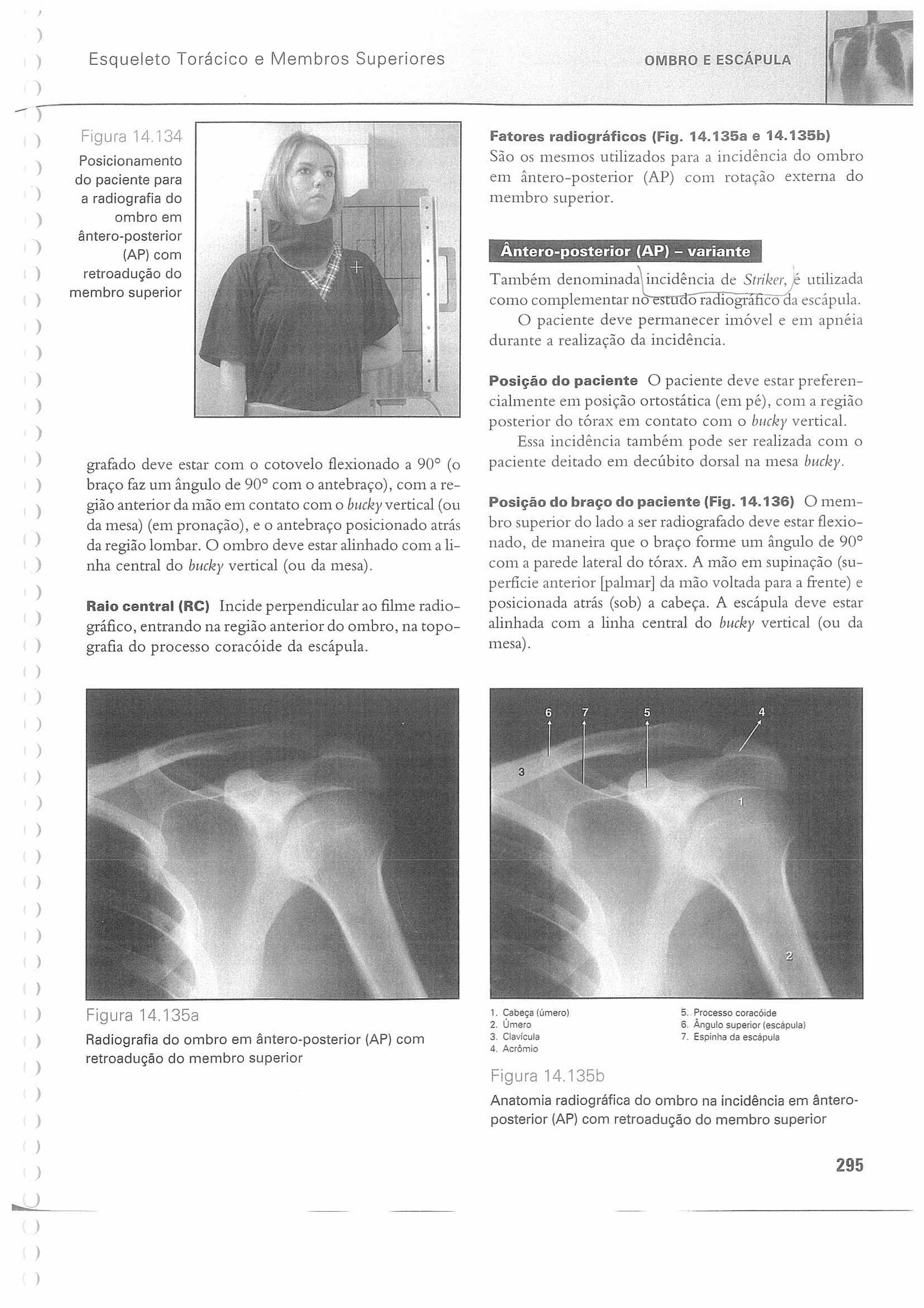 Esqueleto Torácico e Membros Superiores OMBRO E ESCÁPULA Figura 14.