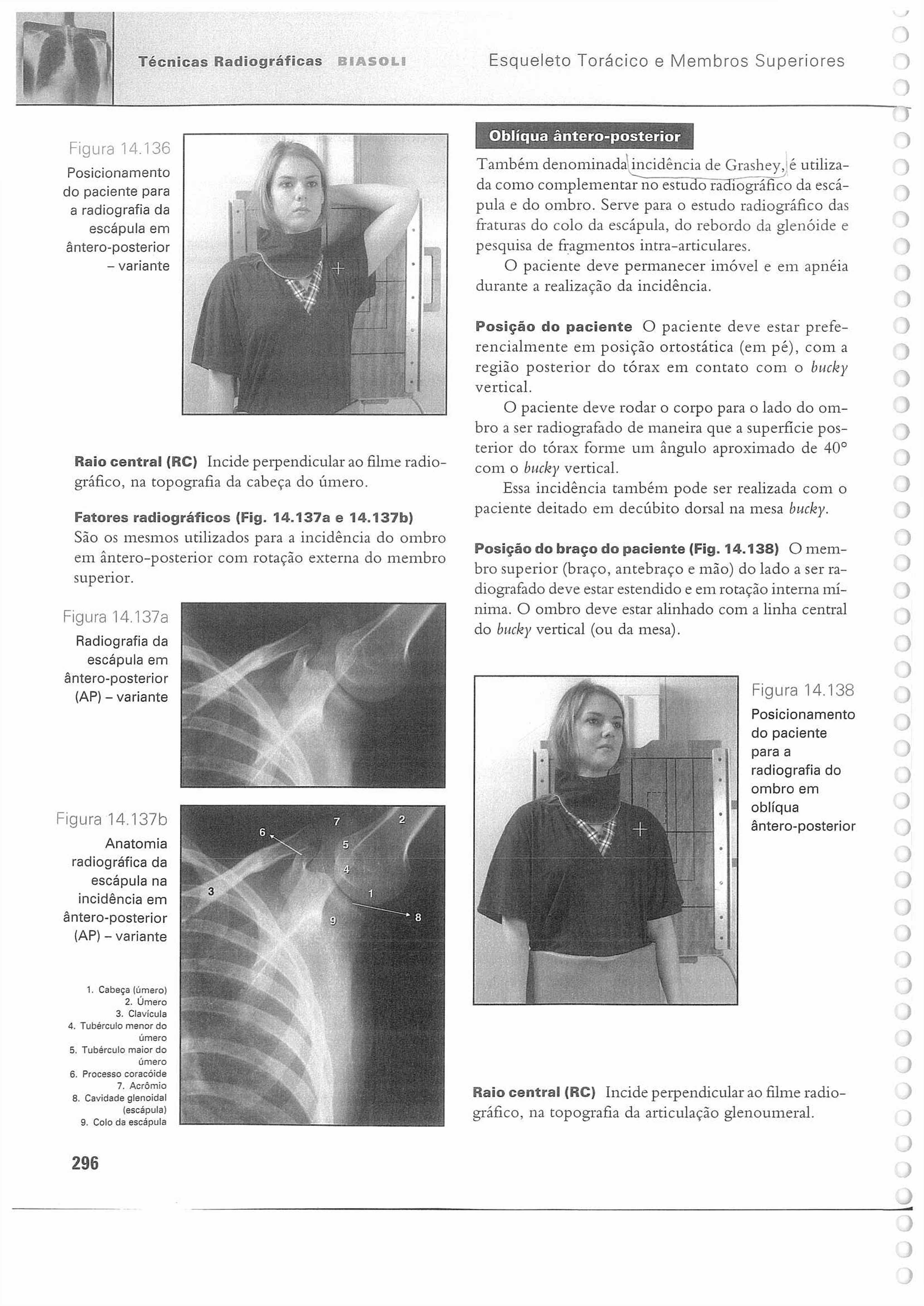 Técnicas Radiográficas BfASOLB Esqueleto Torácico e Membros Superiores Figura 14.136 do paciente para a radiografia da escápula em - variante na topografia da cabeça do úm ero.