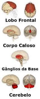 Segundo algumas pesquisas este problema tem sua origem em uma condição orgânica, relacionada a uma estrutura cerebral chamada lobo pré-frontal.